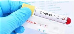 Δήμος Καλαμαριάς: Πού θα διενεργούνται rapid test